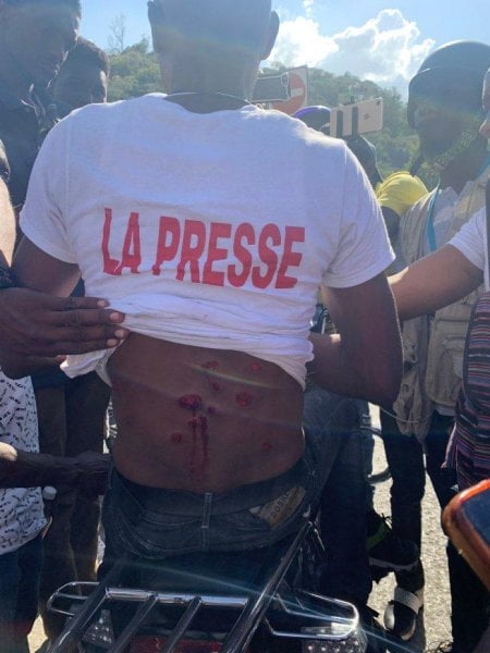 Marche à Port-au-Prince : encore deux journalistes blessés par balles - dictature, journalistes, Manifestation, marche, ONU, Police